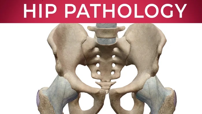 Hip Labral Tears