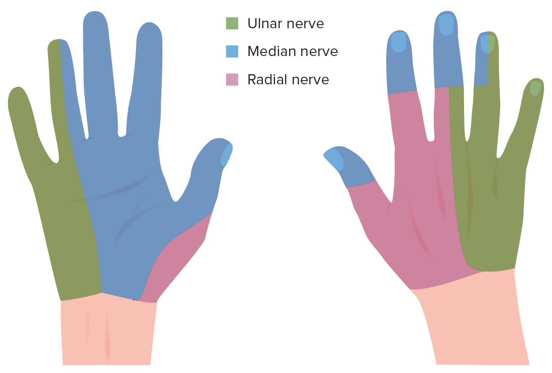 Upper Extremity Nerve Glides