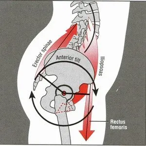 anterior pelvic tilt pelvis physical therapy pt corner lyt yoga online classes